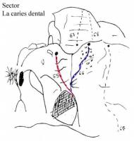 Croquis La Caries Dental: Escalada en Castellet - Croquis La Caries Dental: